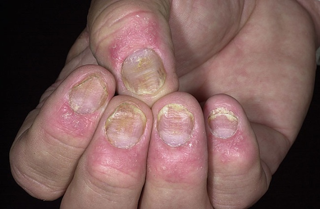 La crema que blanquea de la farmacia