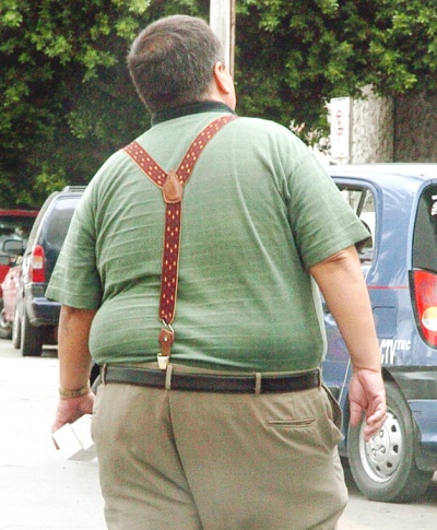 Sugiere IMSS cirugía bypass gástrico para obesidad Sugiere IMSS cirugía bypass gástrico para obesidad